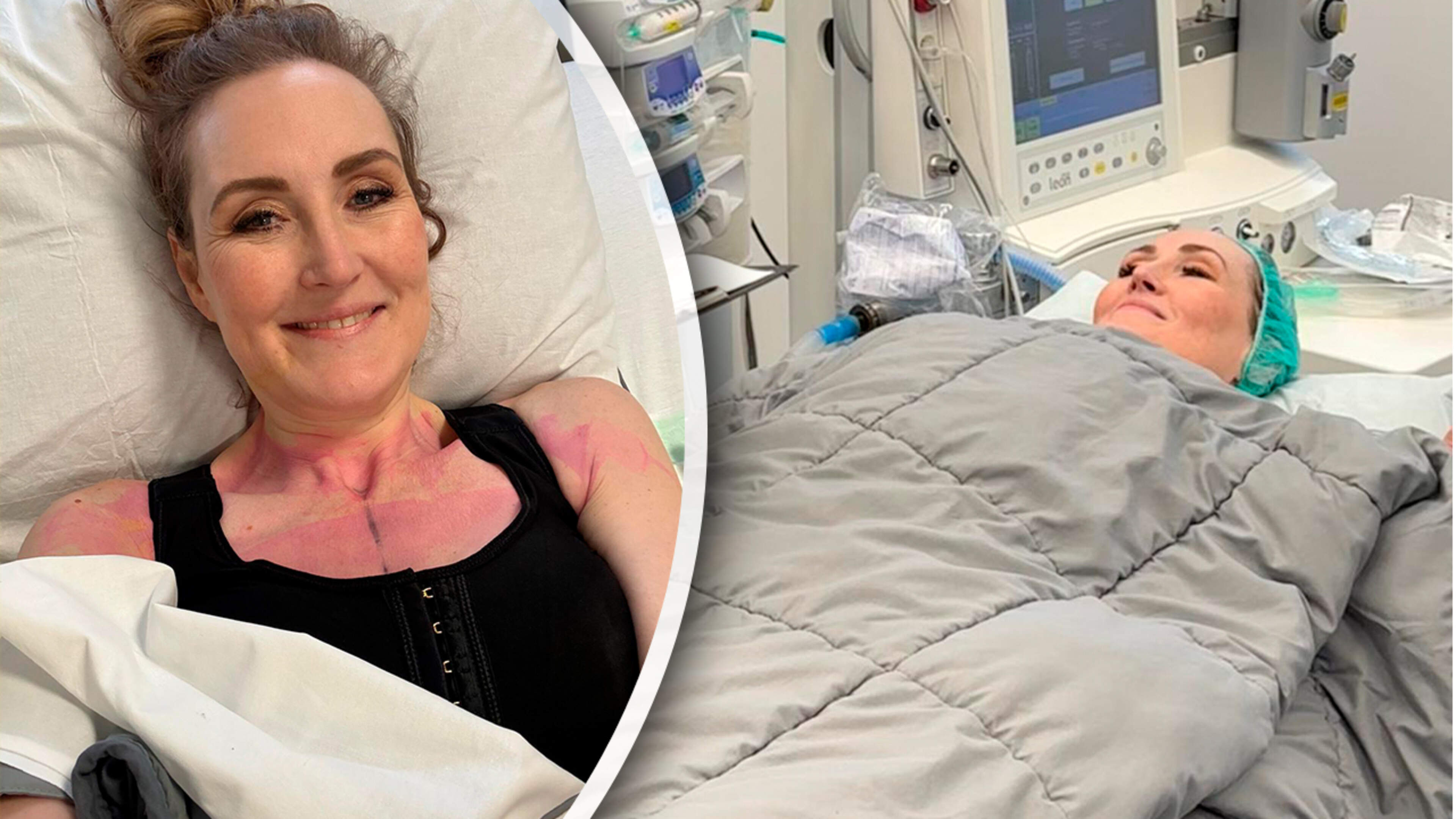 Hannelore Zwitserlood (50) kiest voor borstvergroting na 55 kilo te zijn afgevallen: ’Mijn volle borsten waren veranderd in slappe theezakjes’